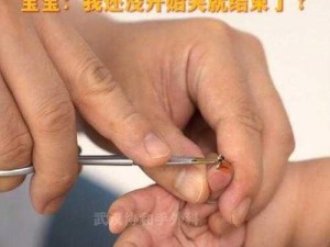 宝宝才两根手指就疼哭了，是怎么回事？