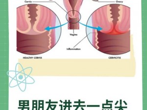 男下部进入女人下部时为什么会疼痛？