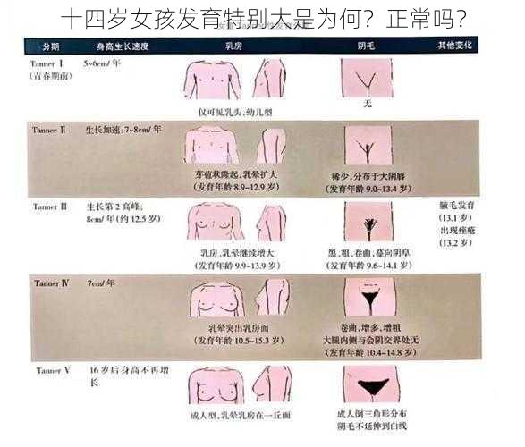 十四岁女孩发育特别大是为何？正常吗？